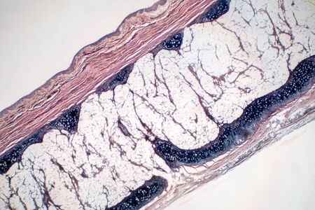 Human hyaline cartilage bone under microscope view for education pathology. Human tissue phisiology.の写真素材