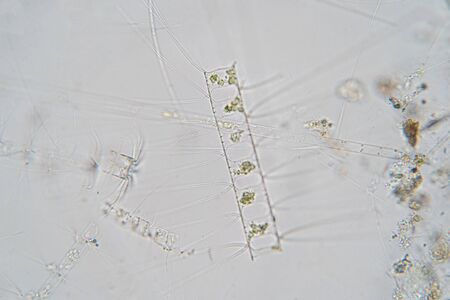 Chaetoceros is marine planktonic diatoms under the microscope view.の写真素材