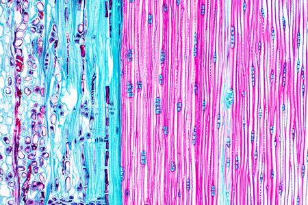 Histological structure of pine stem vascular bundle under the microscope.の写真素材
