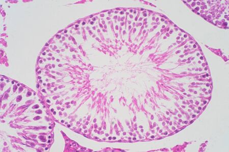 Human testis under the microscope view. Shows spermatogonia, spermatocytes in meiosis, spermatids,...