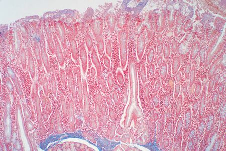 Duodenum biopsy from the pathology of  small intestine. Education for human histology.の写真素材