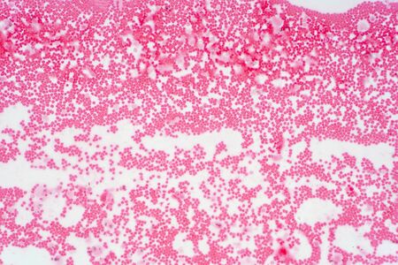 Pathology study of human stem cell under the microscope.