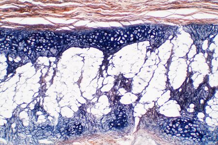 Cartilage is a resilient and smooth elastic tissue for pathology education, a rubber-like padding that covers and protects the ends of long bones at the joints.の写真素材