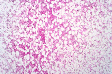 Human bone marrow under the light microscope view. Haematoxylin and eosin staining technique for histology.の写真素材