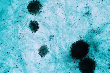Aspergillus (mold) under the light microscopic view for education.の写真素材