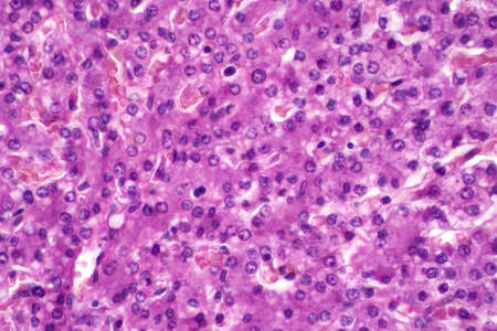 Hepatocyte is cell of the main parenchymal tissue of the liver under the light microscope. Haematoxylin and eosin staining technique for human tissue.の写真素材
