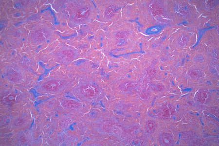 Light microscope of Spleen histology for education. The spleen is the largest mass of lymphatic tissue in the body. Haematoxylin and eosin staining technique.の写真素材