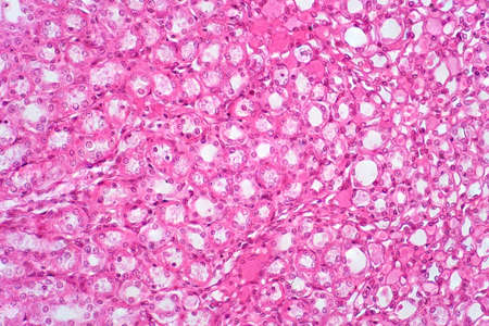 Histology of human kidney tissue under light microscope view for education. Haematoxylin and eosin staining technique for histology.の写真素材