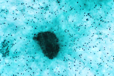 Aspergillus (mold) under the light microscopic view for microbiology education.の写真素材