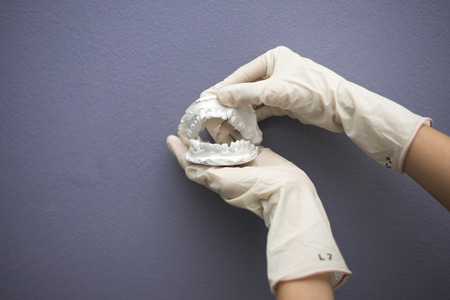 Dentist hand with plaster modelの写真素材