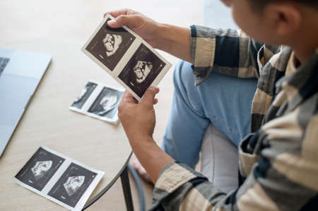 Young father holding ultrasound photo of newborn baby, maternity and family conceptの写真素材