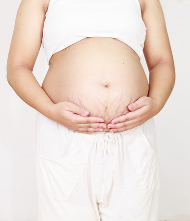 Closeup of a pregnant belly with stretch marks  Isolated on whiteの写真素材