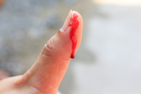 Hand in blood Caught shrimp bites Shrimp yabbie crayfish (Cherax destructor)の写真素材
