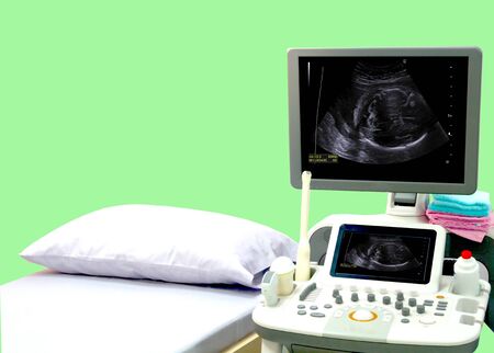 Blurry Medical ultrasound machine with 3D%2F4D image in a hospital diagnostic room. Modern medical equipment  preventional medicine and healthcare concept.の写真素材