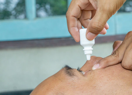 Closeup Of men applying eye drops on inflamed or conjunctivitis eye. Medical healthcare concept.の写真素材