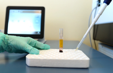Medical clinic Pathological bacteria cultivation sample testの写真素材