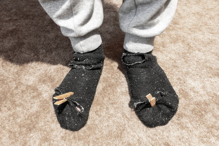 Worn out leaky socks during the financial crisisの写真素材