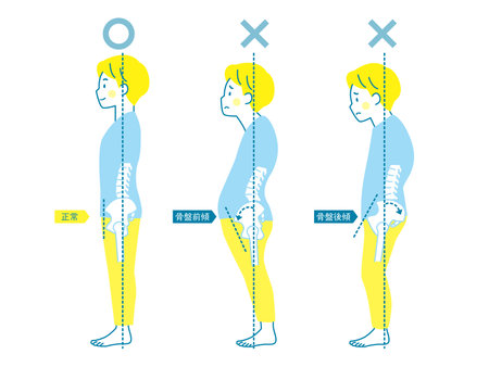 Sample of good and bad posture in men_pelvisのイラスト素材