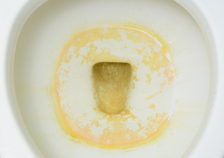 Dirty WC.の写真素材