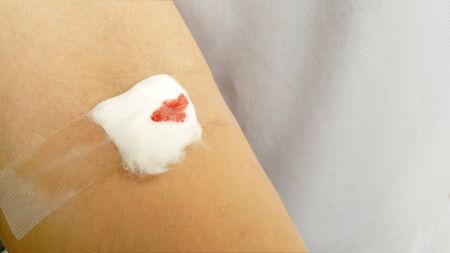 Bleeding cotton  bandage from blood check up wound in  patient that taken platelet aggregation...