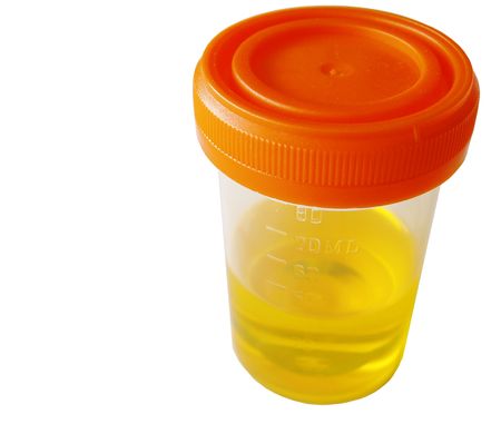 urine sample isolated on white background