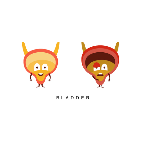 Healthy vs Unhealthy Bladder Infographic Illustration.Humanized Human Organs Childish Cartoon Characters On White Backgroundのイラスト素材