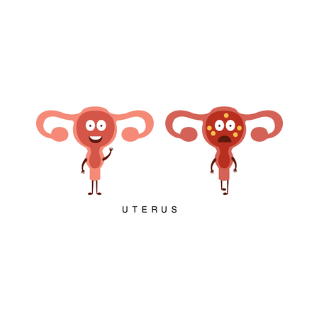 Healthy vs Unhealthy Uterus Infographic Illustration.Humanized Human Organs Childish Cartoon Characters On White Backgroundのイラスト素材