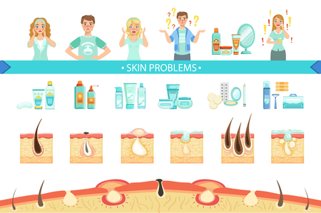 Skin Problems Infographic Medical Poster. Cartoon Style Healthcare Acne Issue Info Illustration. Flat Vector Simplified Illustration On White Background.のイラスト素材