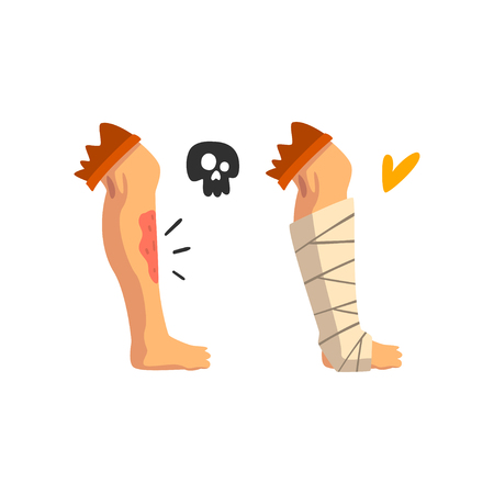 Wounded leg, physical injury, bandaged leg, first aid and treatment vector Illustration isolated on a white background.のイラスト素材