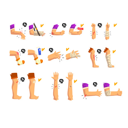Damaged body parts set, injuries and fractures of the arms and legs, first aid and treatment vector Illustration isolated on a white background.のイラスト素材