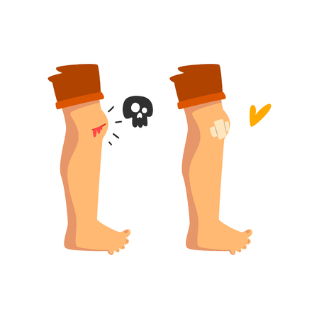 Bleeding wound on the knee, sticking plaster, physical injury, first aid and treatment vector Illustration isolated on a white background.のイラスト素材