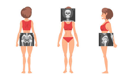 Young Woman Standing in Red Underwear with Her Skeleton X-ray Vector Setのイラスト素材