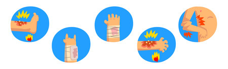 Human Body Physical Injury and Wound Vector Setのイラスト素材