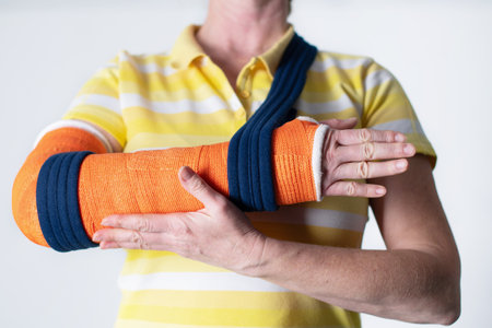 woman with a broken right arm wearing plaster casts to hold the broken bones in place until they...