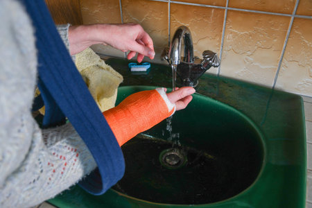 woman with broken arm in cast checks the temperature of the tap water for washing her hands, the concept of changes in the sensitivity of the limb after an injury,の写真素材