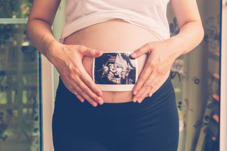 Close up hand pregnant woman holding ultrasound scan on tummy