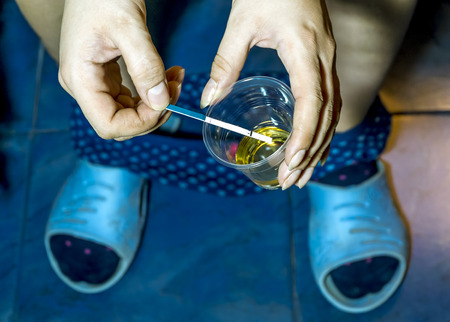 The girl checks pregnancy test urine Cup  in the bathroomの写真素材