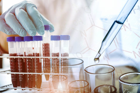 lab technician assistant analyzing a blood sample in test tube with dropping liquid sample to test...