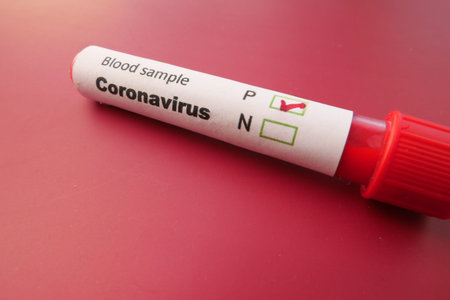 Corona virus blood test tube on red background.