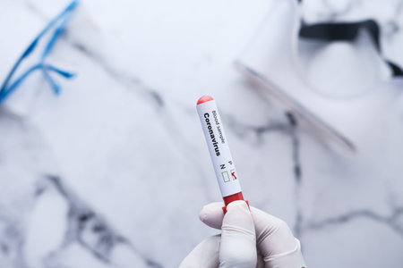 laboratory technician hand holding blood test tubeの写真素材