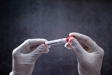 laboratory technician hand holding blood test tube