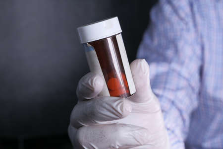 close up of doctor hand in protective gloves holding containerの写真素材