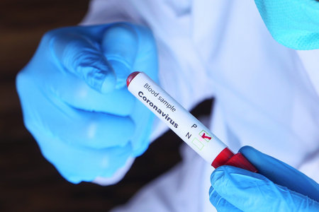 hands of laboratory technician holding blood test tube