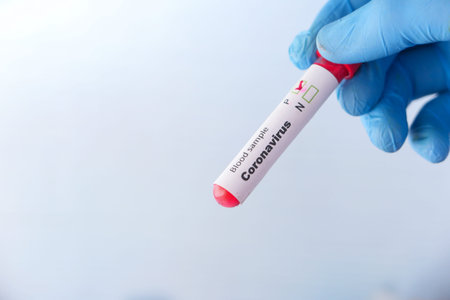 laboratory technician hand holding blood test tube