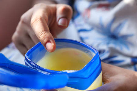 woman using petroleum jelly onto skin at home close up.の写真素材