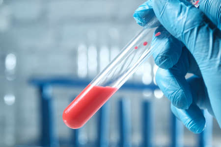 laboratory technician hand holding blood test tubeの写真素材