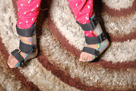 Child cerebral palsy disability, legs orthosis.