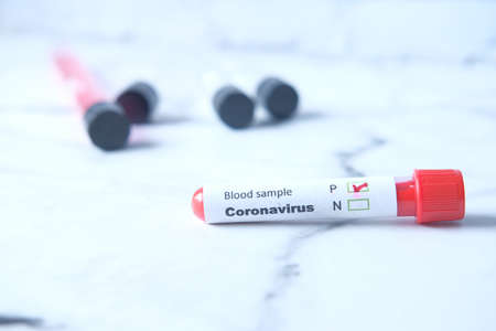 close up of corona virus blood test tube on white backgroundの写真素材
