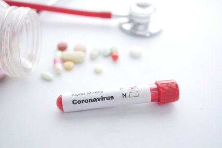 close up of corona virus blood test tube on white backgroundの写真素材