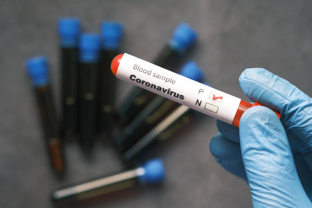 hand in blue medical gloves holding blood test tubeの写真素材